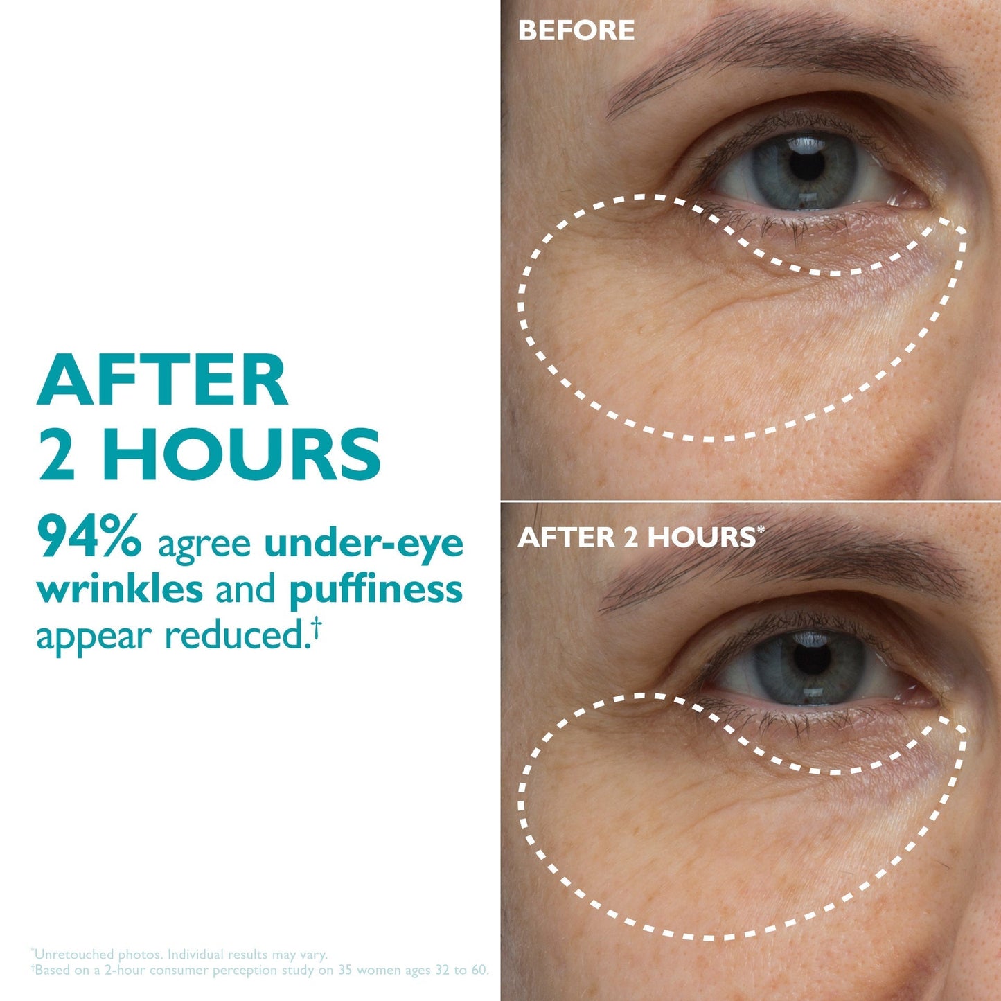Peptide-Infused Face & Eye Tape