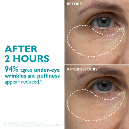Peptide-Infused Face & Eye Tape
